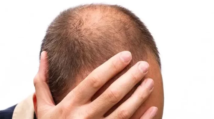 rambut rontok