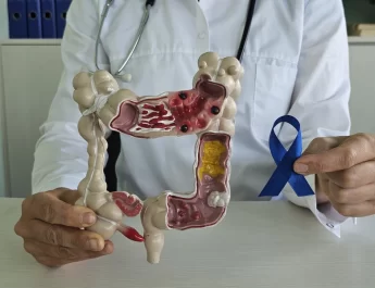 kanker usus